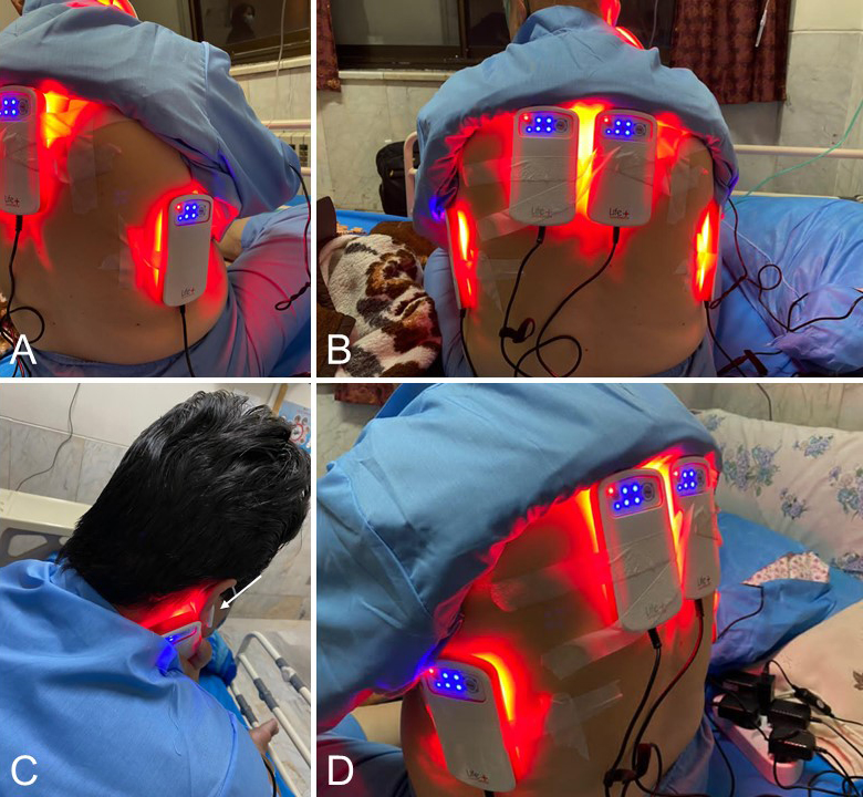 Thérapeute traitant un patient avec l&#39;acupuncture LED RedPoint Acupucnture